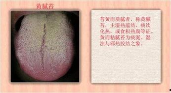 成人舌苔去除视频,揭秘成人健康密码