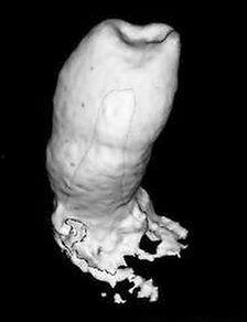 镶牙齿视频成人,成人生涯中的美丽蜕变