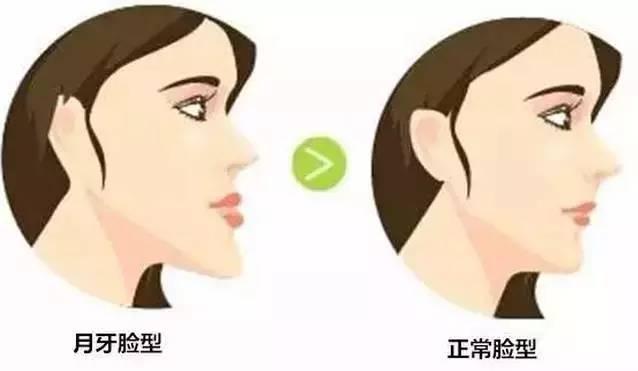 成人牙弓歪斜怎么矫正视频,视频教程深度解读